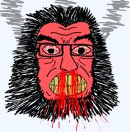 angry beard blood bloodshot_eyes clenched_teeth fume glasses hair red_face soyjak variant:soydoz yellow_teeth // 600x610 // 1.4MB