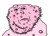 acne blood pink_skin sad stubble teeth ugly variant:impish_soyak_ears // 959x688 // 122.9KB