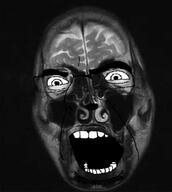 brain glasses irl irl_background mri open_mouth skull soyjak stubble variant:cobson // 448x500 // 31.8KB